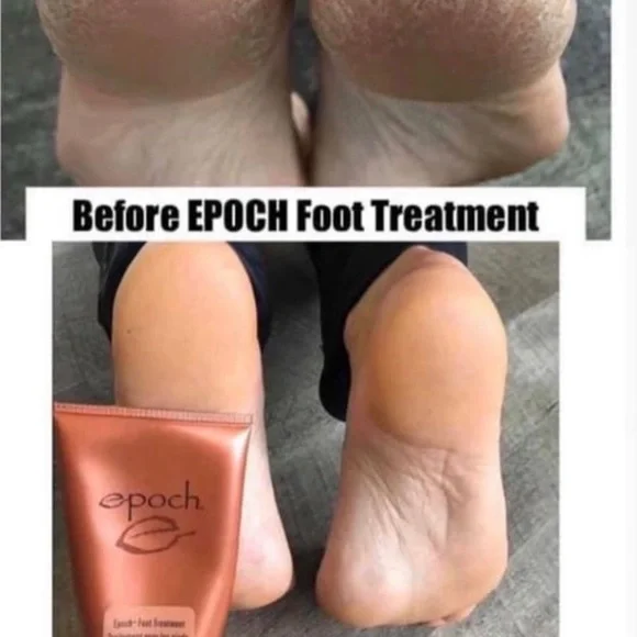 - (2) TWO Epoch NuSkin Sole Solution foot treatment